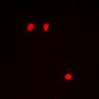 3 - Anti-Histone H3 (Phospho-S10) Antibody AP59740