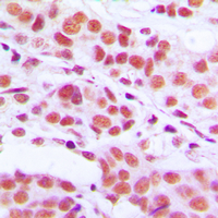 19 - Anti-Histone H3 (Phospho-S10) Antibody AP59740