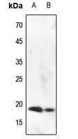 1 - Anti-Histone H3 (Phospho-S10) Antibody AP59740
