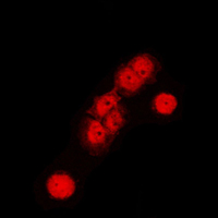 3 - Anti-Cullin 1 Antibody [KO/KD Validated] AP59742