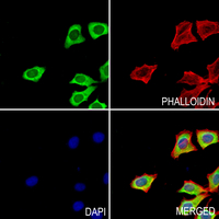 3 - Anti-PPFIBP1 Antibody AP59743