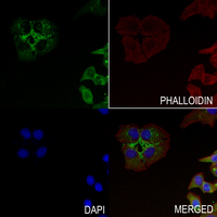 3 - Anti-MMP23 Antibody AP59744
