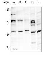 1 - Anti-HAT1 Antibody AP59745