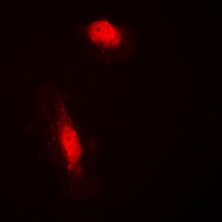 3 - Anti-COPS3 Antibody [KO/KD Validated] AP59746