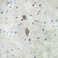 19 - Anti-MADD Antibody AP59748