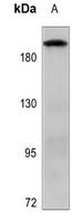 1 - Anti-MADD Antibody AP59748