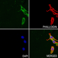 3 - Anti-EIF3F Antibody AP59749