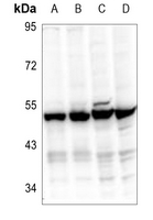 1 - Anti-EIF3F Antibody AP59749