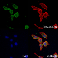 3 - Anti-B3GALT1 Antibody AP59751