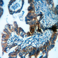 19 - Anti-MRP3 Antibody AP59752