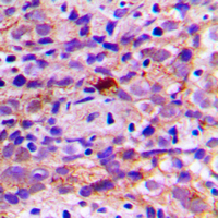19 - Anti-CES2 Antibody AP59757