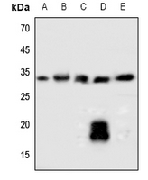 1 - Anti-SOCS2 Antibody AP59759