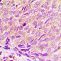 19 - Anti-Histone Deacetylase 3 Antibody AP59760