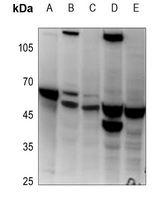 1 - Anti-Histone Deacetylase 3 Antibody AP59760