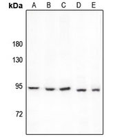 1 - Anti-PCAF Antibody AP59761