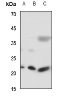 1 - Anti-RAB7L1 Antibody AP59762