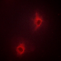 3 - Anti-Nop30 Antibody AP59763