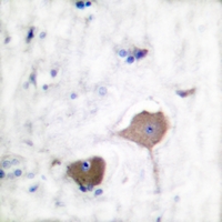 19 - Anti-Nop30 Antibody AP59763