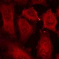 3 - Anti-DOK2 (Phospho-Y299) Antibody AP59764