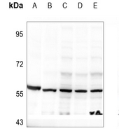 1 - Anti-DOK2 (Phospho-Y299) Antibody AP59764