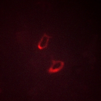 3 - Anti-Claudin 1 Antibody AP59766