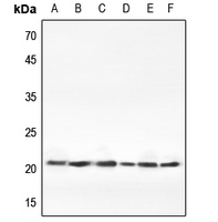 1 - Anti-Claudin 1 Antibody AP59766