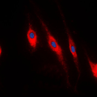 3 - Anti-PDLIM1 Antibody [KO/KD Validated] AP59768