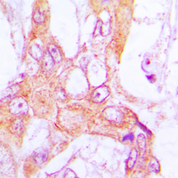 19 - Anti-PDLIM1 Antibody [KO/KD Validated] AP59768