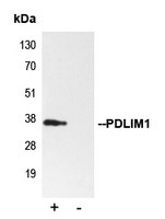 5 - Anti-PDLIM1 Antibody [KO/KD Validated] AP59768