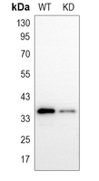 0 - Anti-PDLIM1 Antibody [KO/KD Validated] AP59768