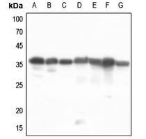 1 - Anti-PDLIM1 Antibody [KO/KD Validated] AP59768