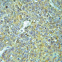 19 - Anti-ARHGEF1 Antibody AP59769
