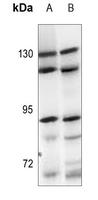 1 - Anti-ARHGEF1 Antibody AP59769