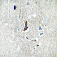 19 - Anti-LZK Antibody AP59771