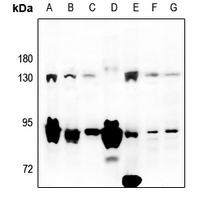 1 - Anti-LZK Antibody AP59771
