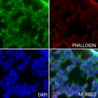 3 - Anti-KCNAB3 Antibody AP59772