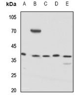 1 - Anti-KCNAB3 Antibody AP59772