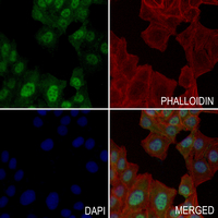 3 - Anti-STK17B Antibody AP59775