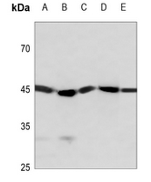1 - Anti-STK17B Antibody AP59775