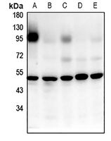 1 - Anti-GPR52 Antibody AP59776