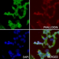3 - Anti-B4GALT5 Antibody AP59777