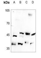 1 - Anti-B4GALT5 Antibody AP59777