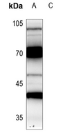 1 - Anti-CRSP7 Antibody AP59778