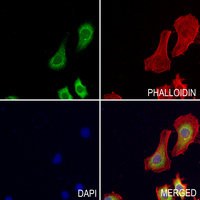 3 - Anti-Synphilin 1 Antibody AP59780