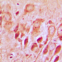 19 - Anti-Synphilin 1 Antibody AP59780