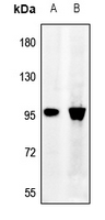 1 - Anti-Synphilin 1 Antibody AP59780