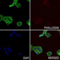 3 - Anti-Nephrocystin 5 Antibody AP59782