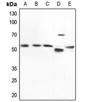 1 - Anti-Nephrocystin 5 Antibody AP59782
