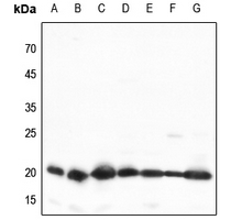 1 - Anti-TOM20 Antibody AP59783
