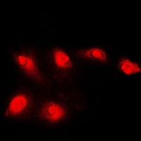 3 - Anti-Histone Deacetylase 5 Antibody AP59786